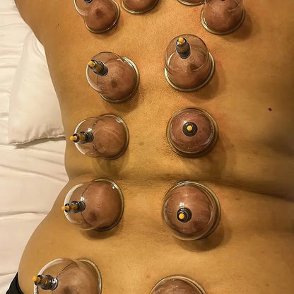 18pcs Suction Vacuum Cupping Set